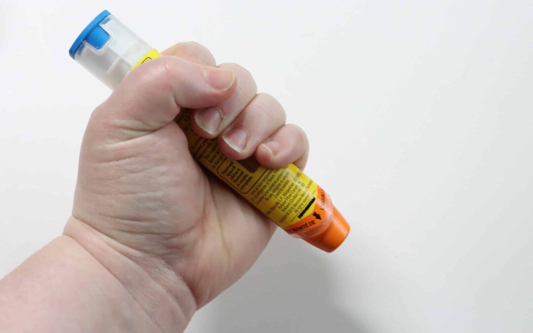 13 Myths, Facts and Controversies about Anaphylaxis