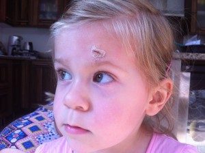 Small head injury