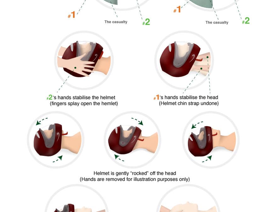 How to Remove a Helmet