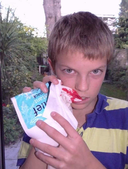 How to save a knocked out tooth