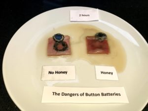 Button batteries can burn