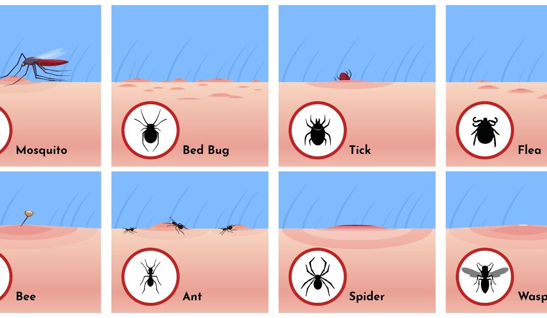 What Bit Me? The Ultimate Guide