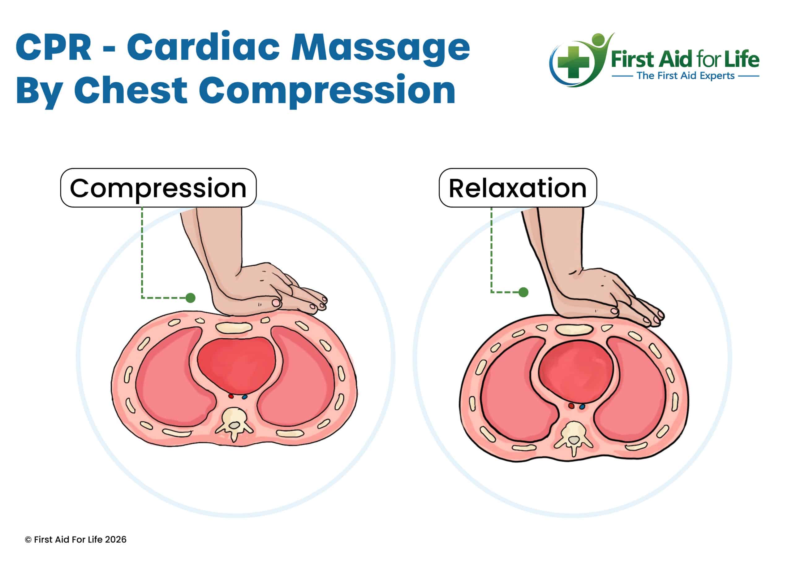CPR diagram