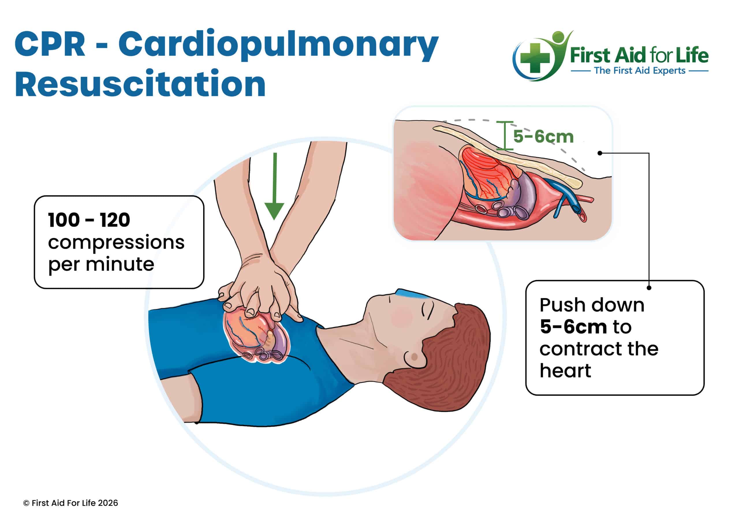 CPR diagram