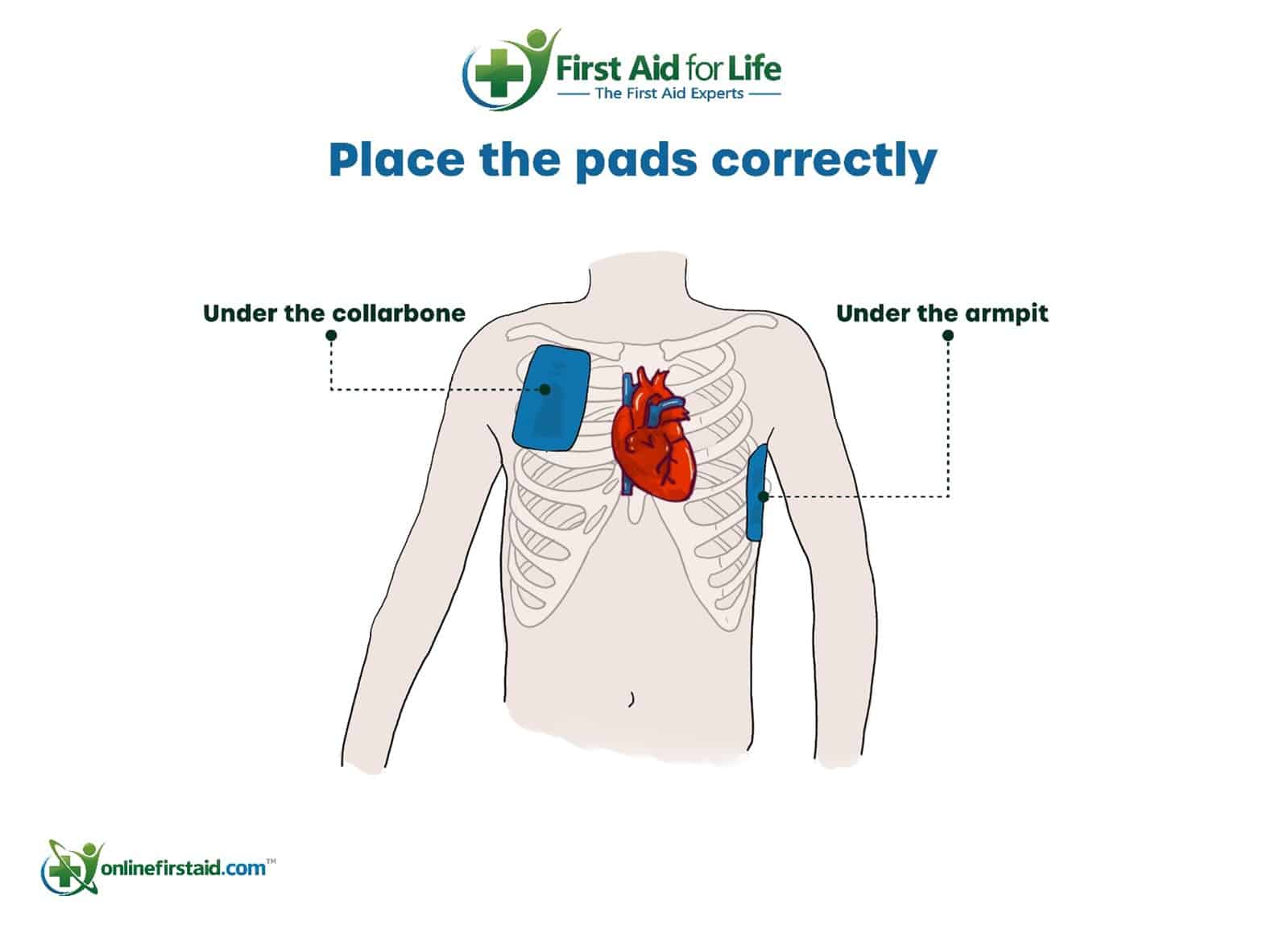 pad placement male