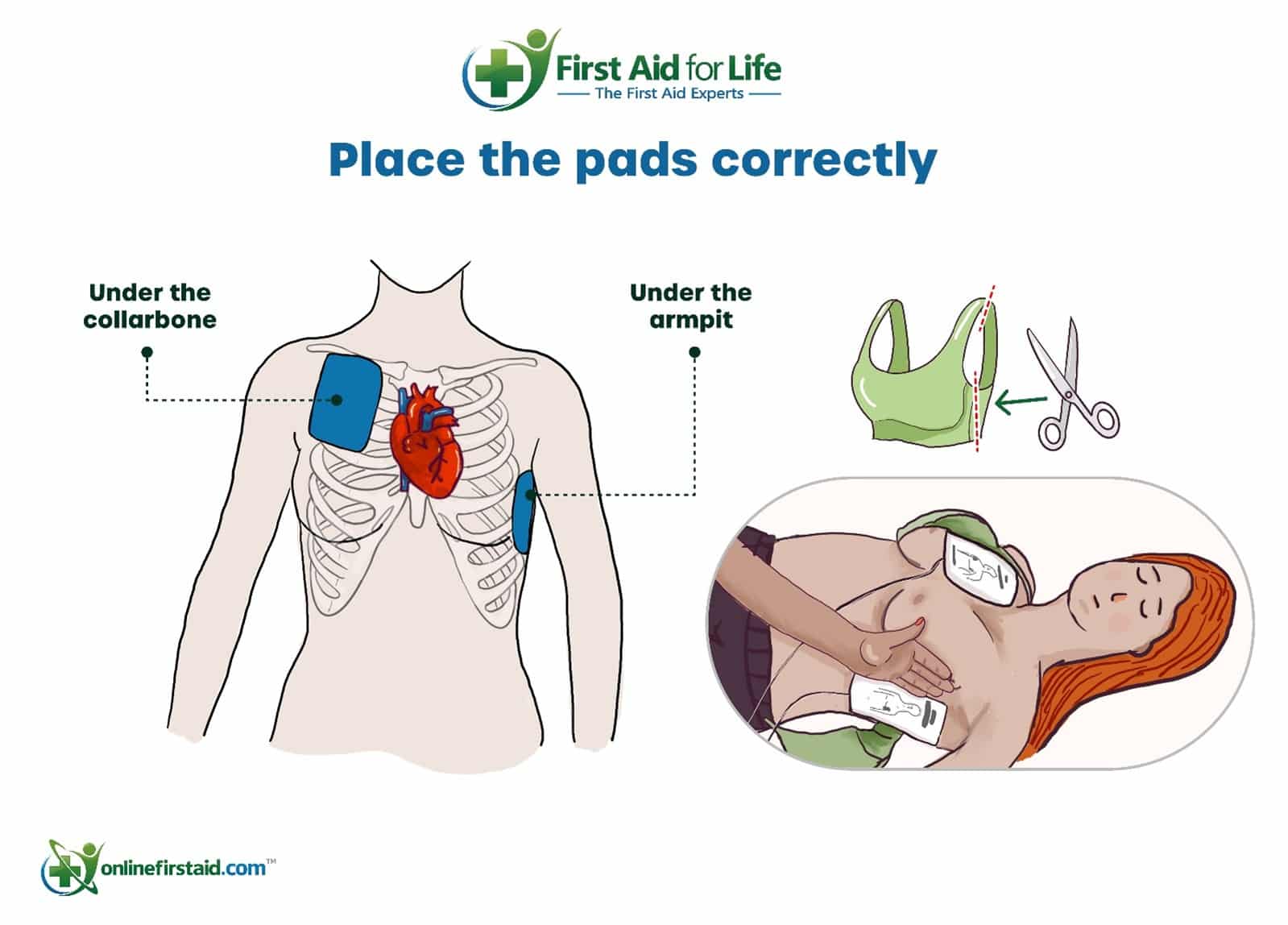 pad placement on woman