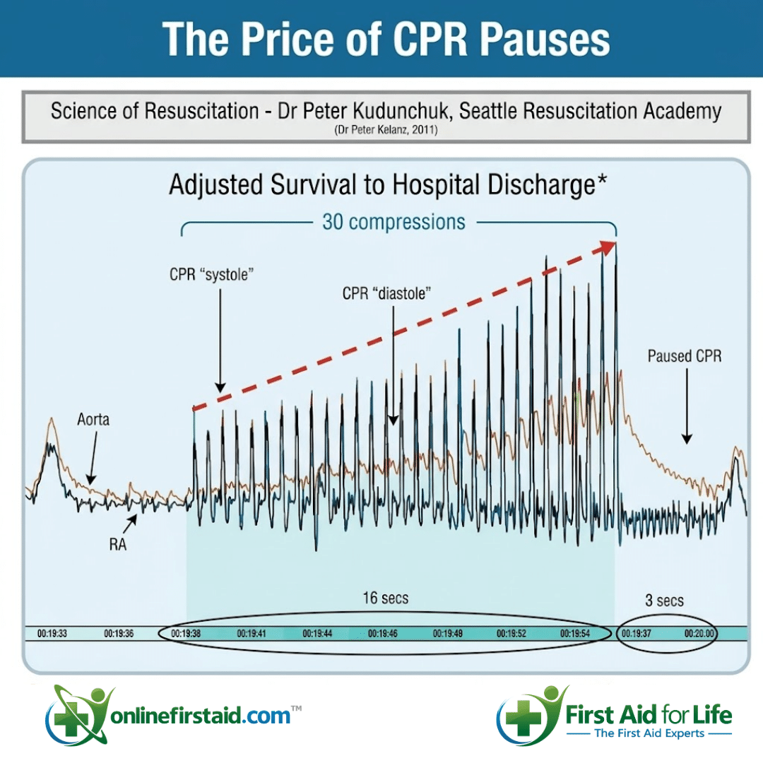 compression pauses diagram