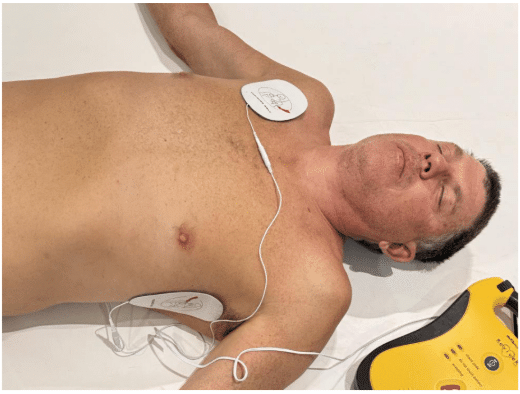 Man with aed pad placement